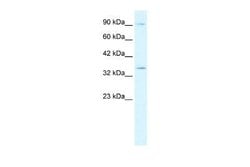 BHLHB5 Rabbit anti-Human, Polyclonal, Novus Biologicals 100 &mu;g; Unconjugated:Antibodies,